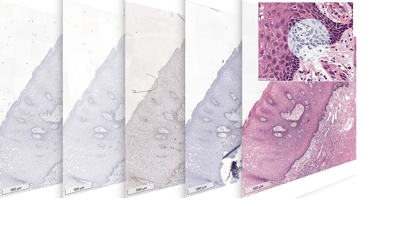Microscopic views illustrating the technology Patho AI & Image Fusion